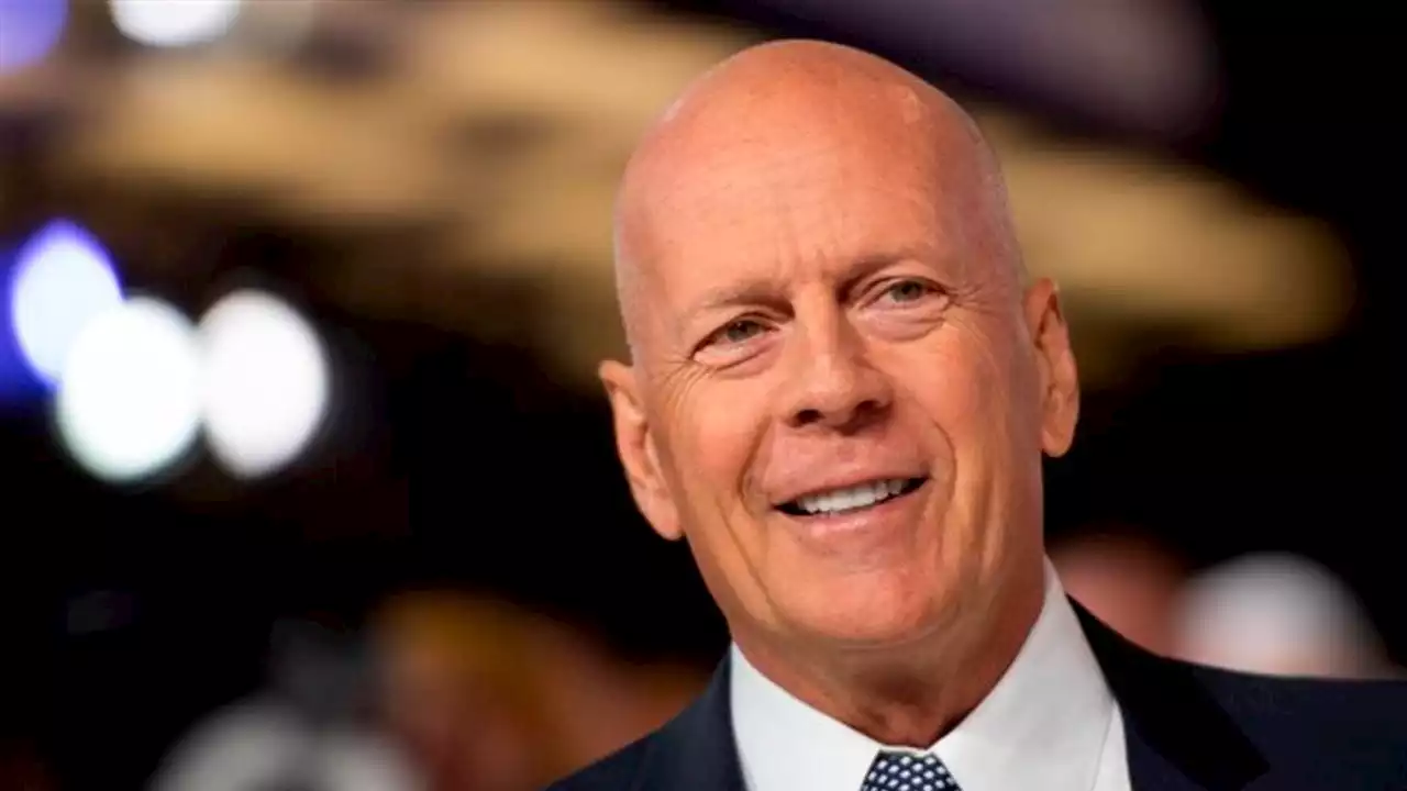 el-actor-bruce-willis-padece-demencia-frontotempor-el-actor-bruce-willis-padece-demencia-frontotempor-1626314633593192452