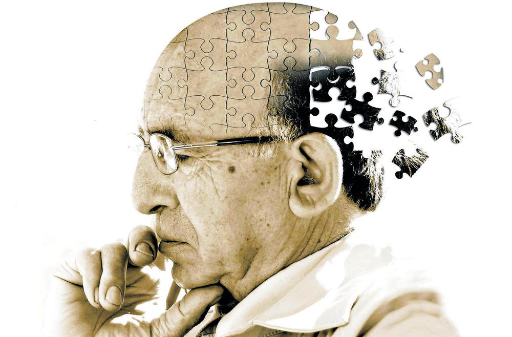 alzheimer-scaled