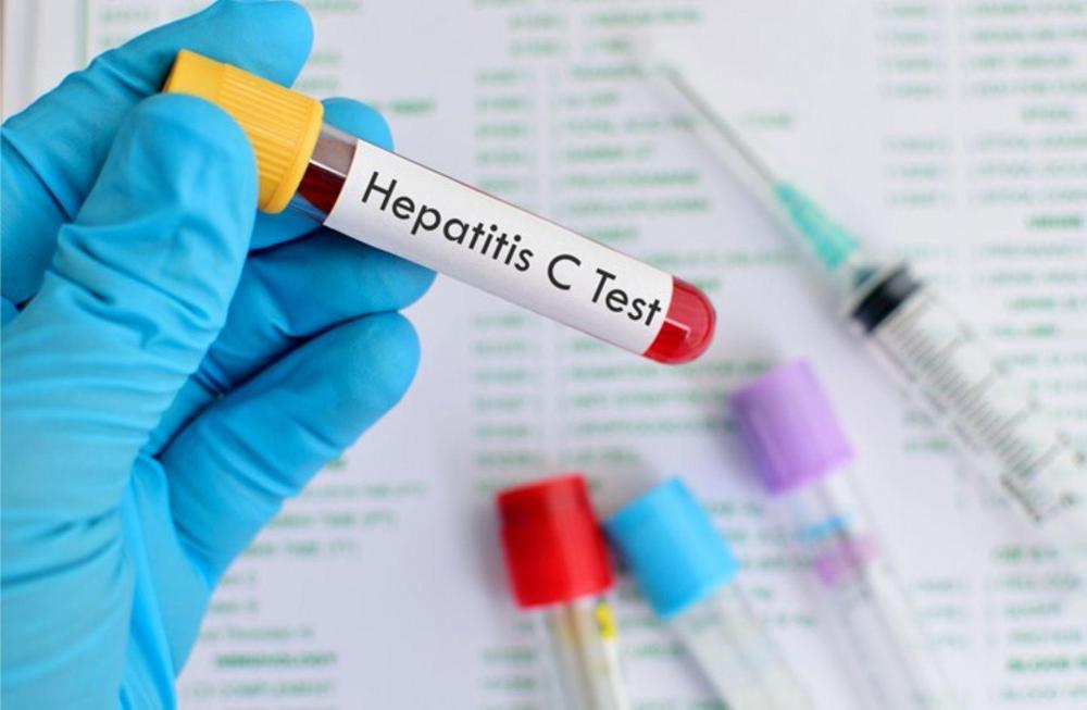 hepatitis