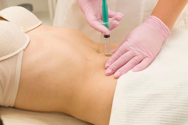 botox-gastrico-turquia