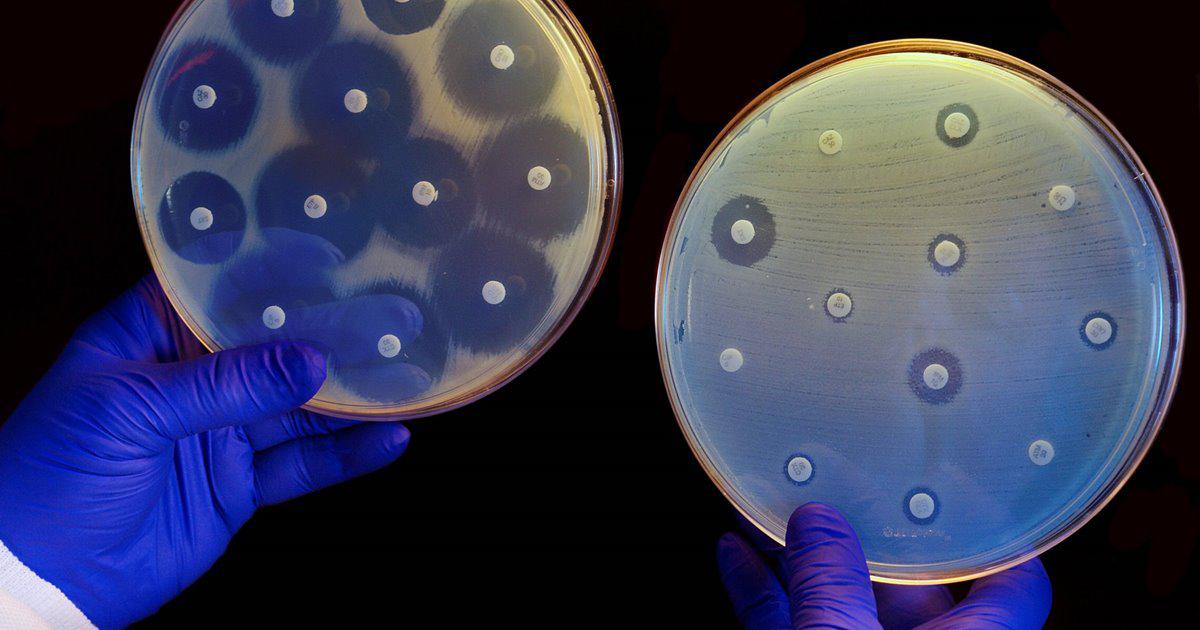 cultivo-de-bacterias-en-dos-placas-de-antibioticos_429ab950_1200x630