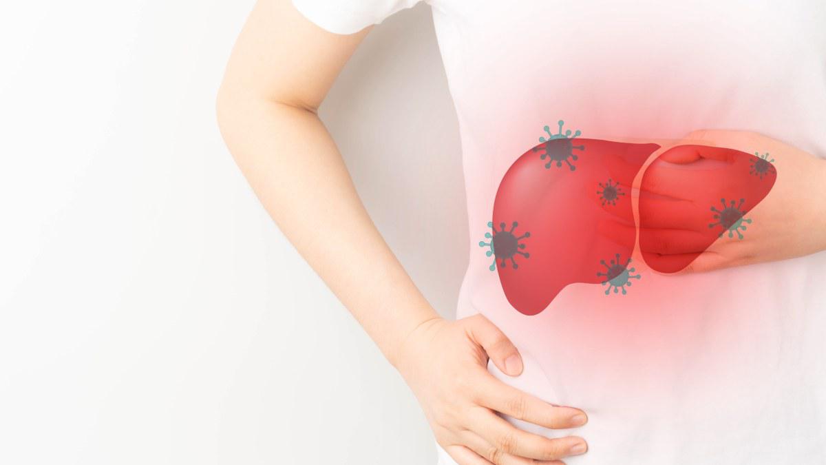 hepatitis-viral