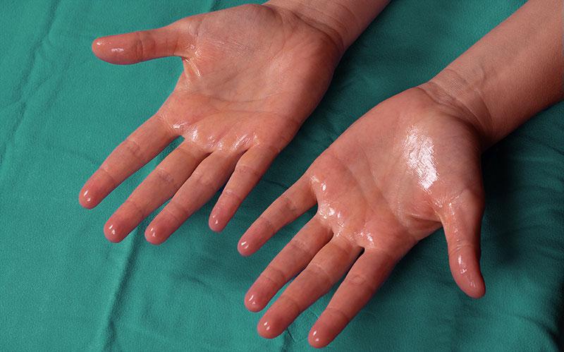 hands-sweaty