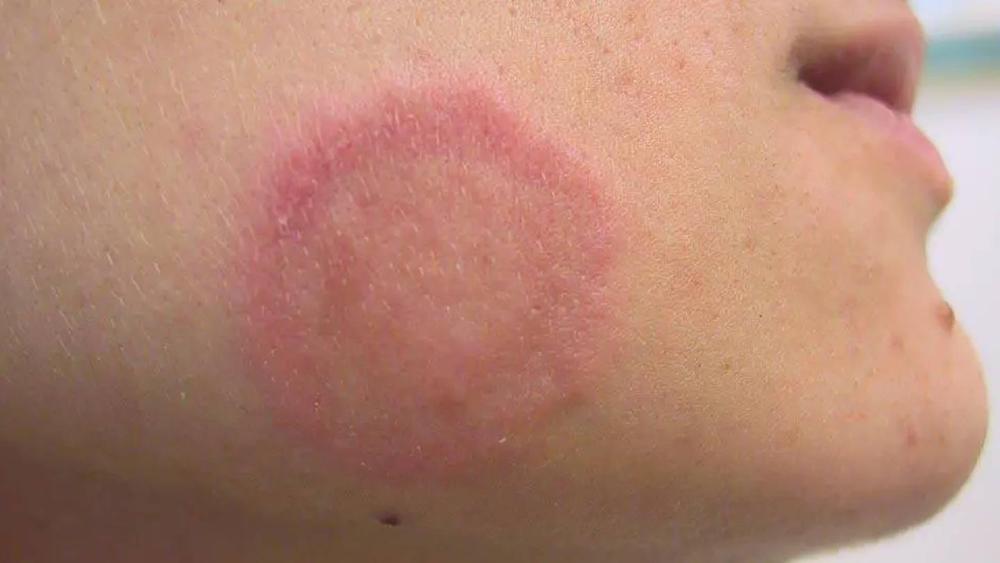 TCO3G5E7M5HG7GGJZMV47SZ6GI