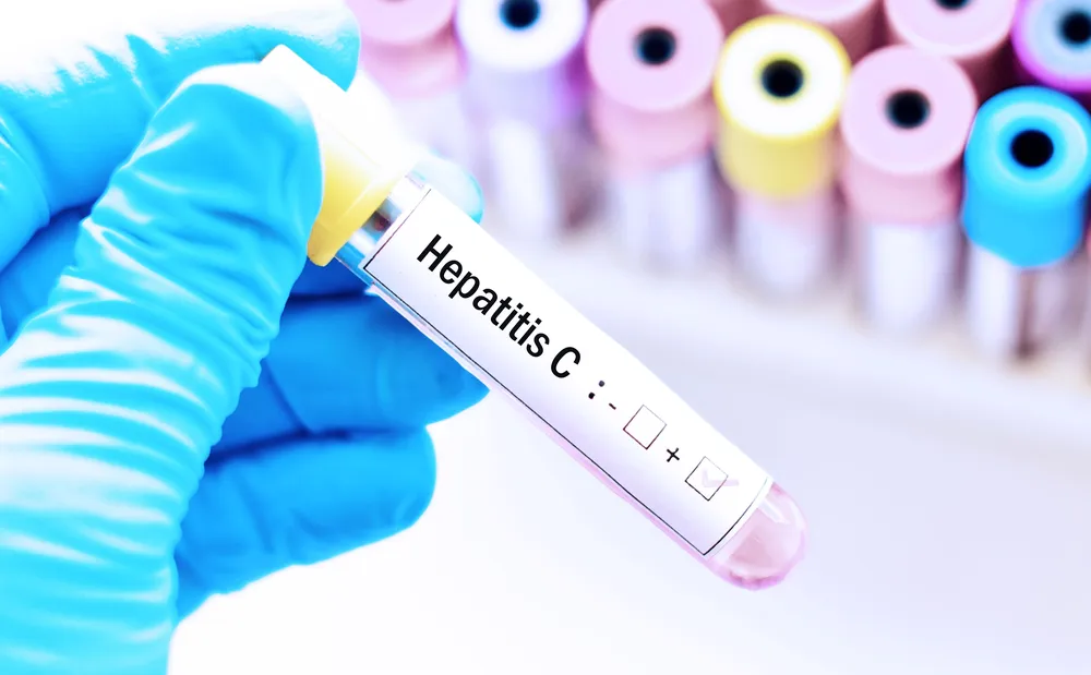 Hepatitis-C