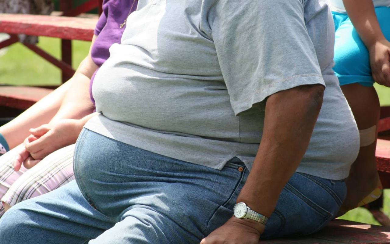 obesidad
