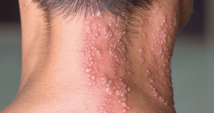 formato-sacs---2024-03-26t173650601-468409c1-focus-0-0-688-364