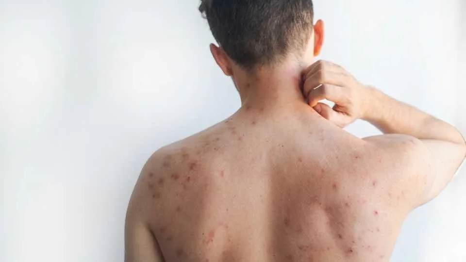 Plecas-e-informacion-2026-02-10T113226.531