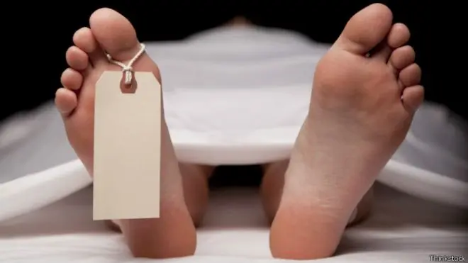 cadaver