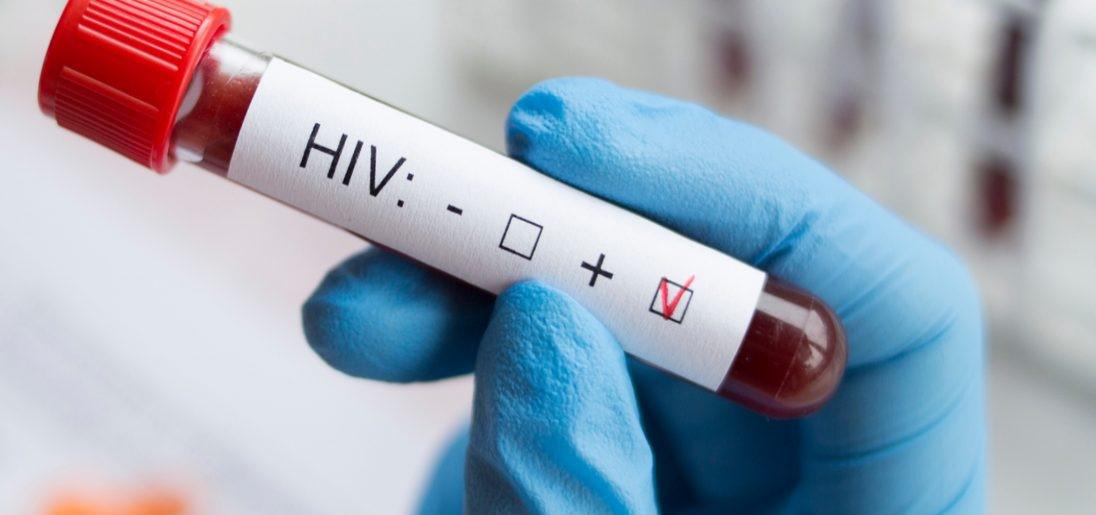 cura-hiv-3355