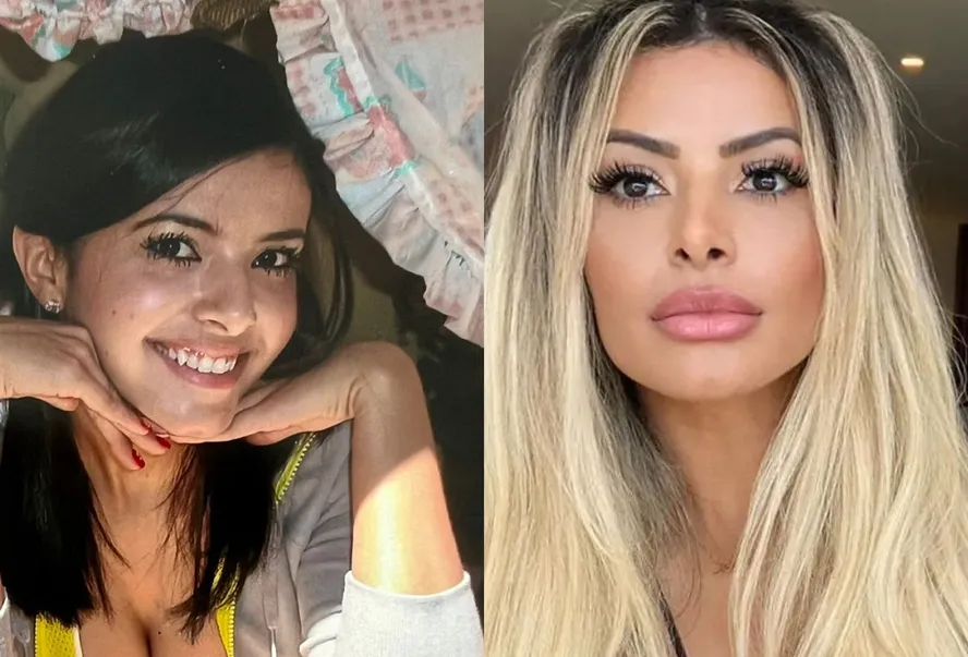 jana-antes-depois