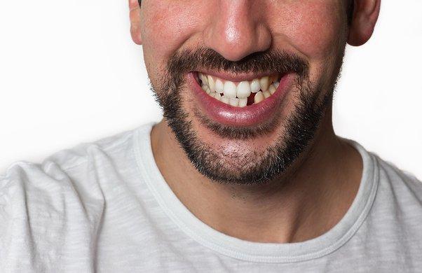 sin dientes
