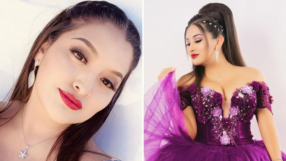 munequita-milly-muere-lipsuccion