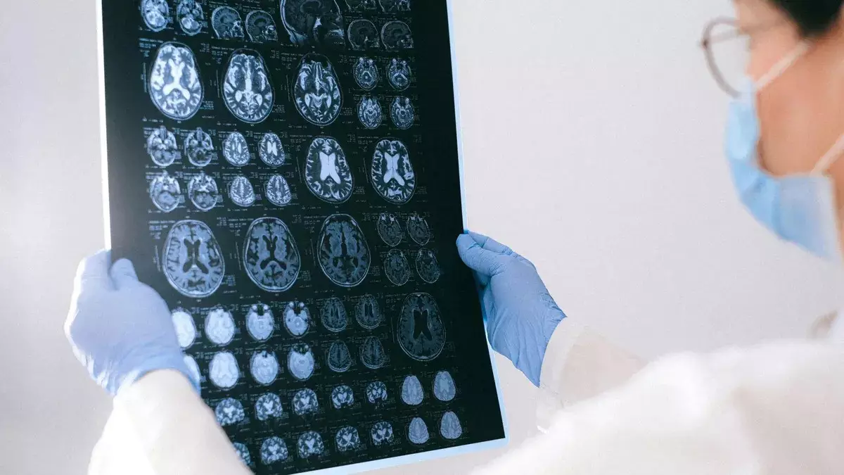 cambios-en-el-cerebro