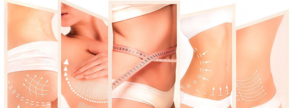 operaciones-de-estética