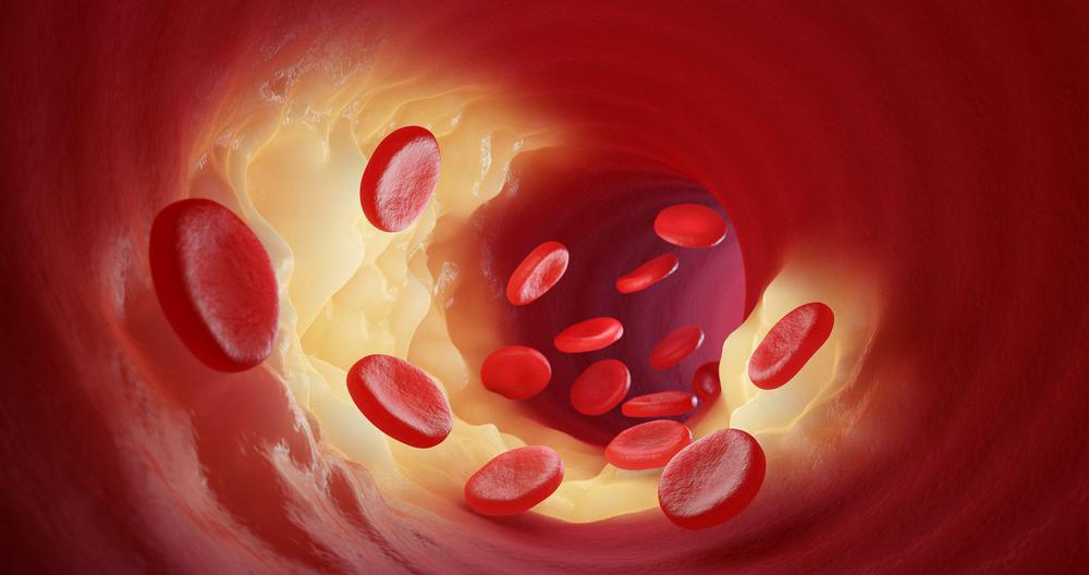 bigstock-red-blood-cells-leak-into-the-461099909