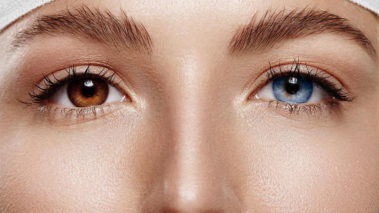 cambiar-color-ojos-operacion-estetica-viral-que-oftalmologos-han-puesto-grito-cielo_69