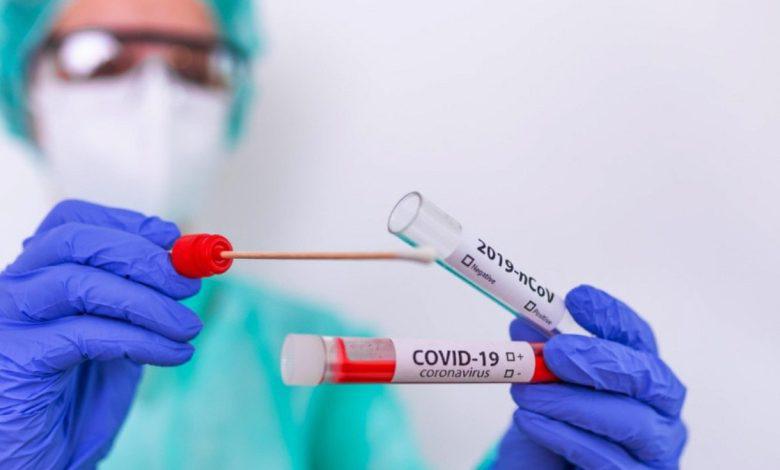 pruebas-covid-.jpg_554688468-780x470