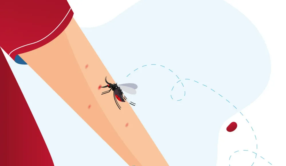 mosquito-bite-1013-589