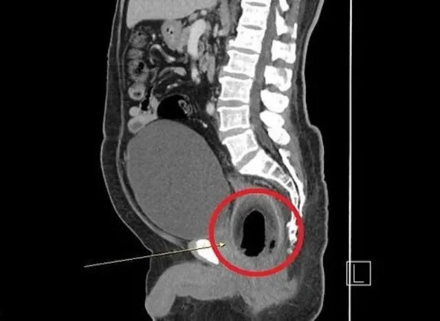 coco_1.jpg_463236260