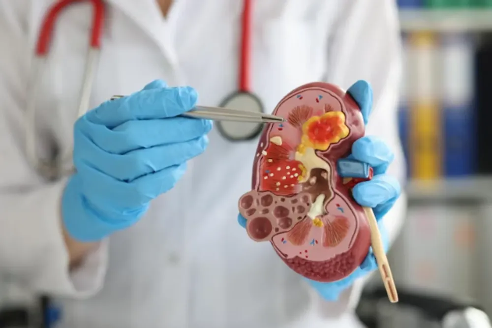 Cual-es-la-funcion-del-rinon