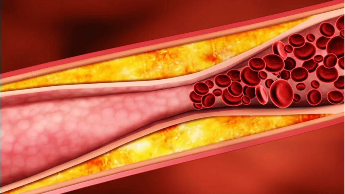 colesterol-1jpg