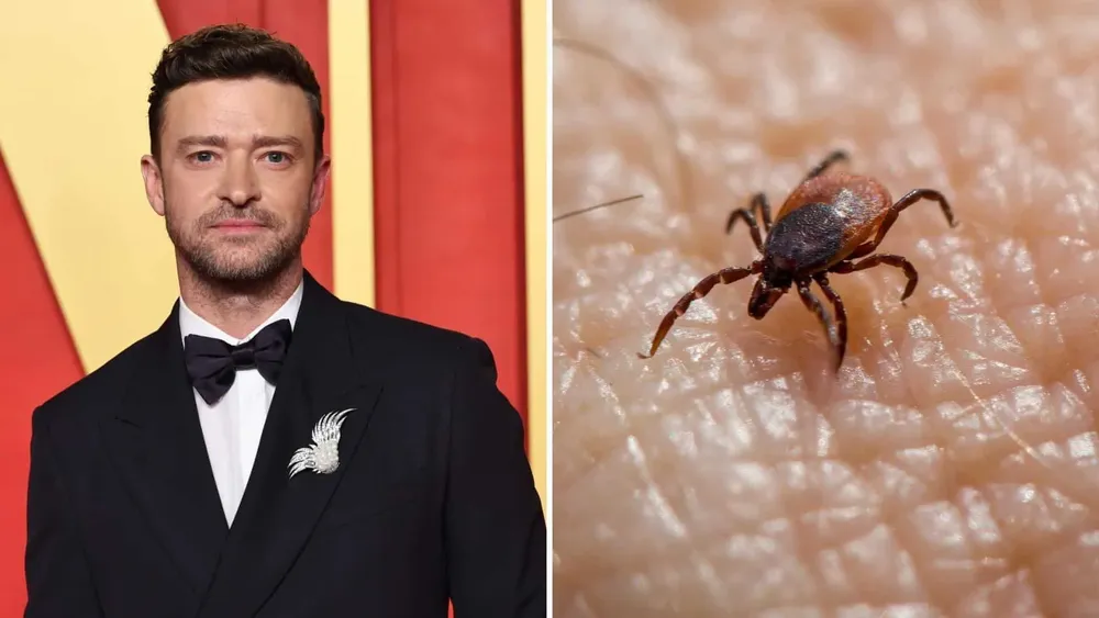 justin-timberlake-enfermedad-lyme-que-es28129-8a6487d0