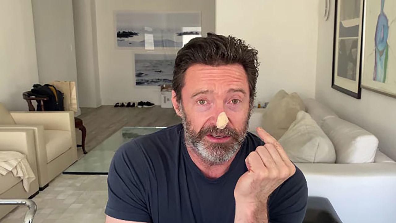 230404085851-hugh-jackman-skin-biopsy-screengrab