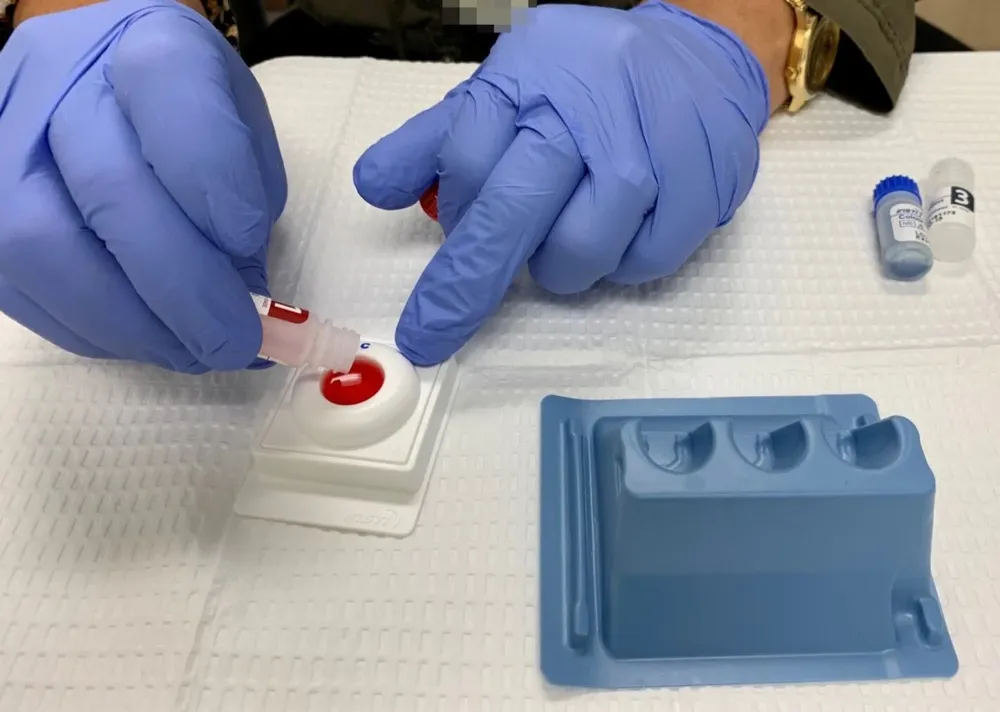 l-gonorrea-enfermedadcurable-dificil-tratar