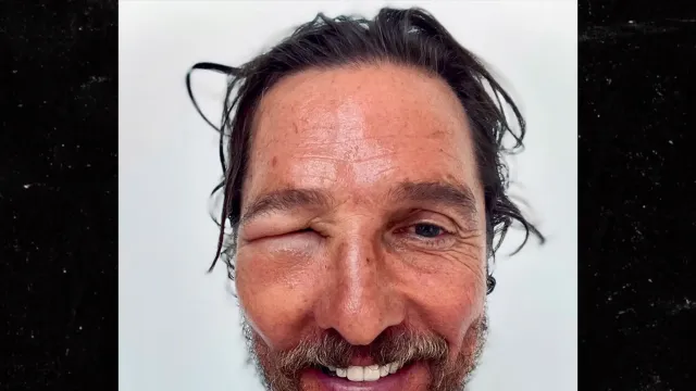 97f01dbffc314c8491cbdb3da87df3e6_xl