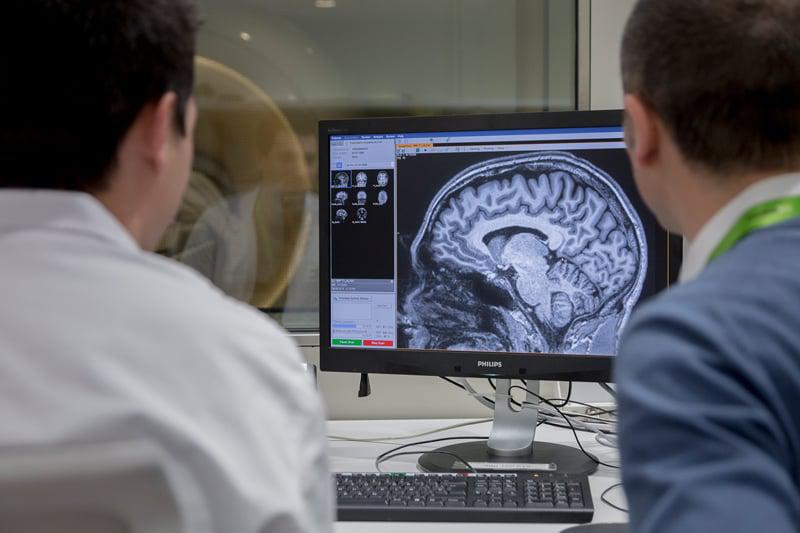 avances-alzheimer-m