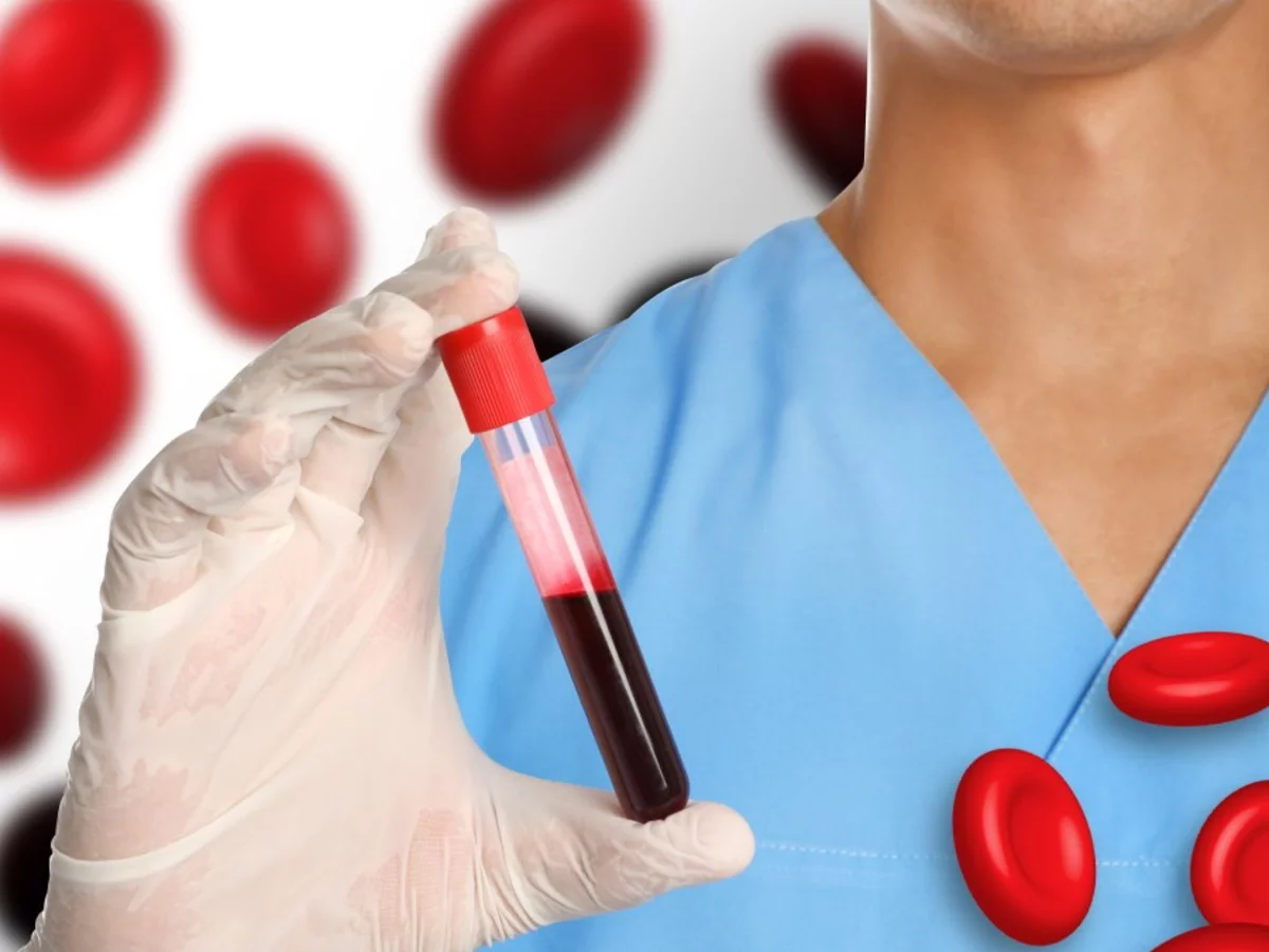diagnostico-anemia.jpg