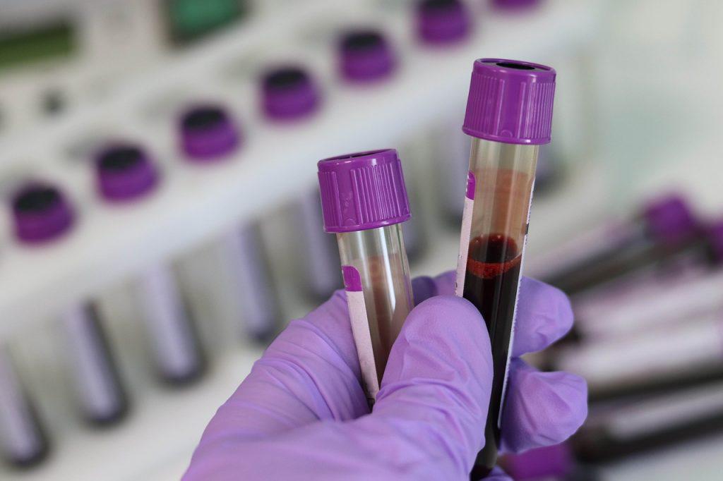 laboratory-3827736_1280-1024x682