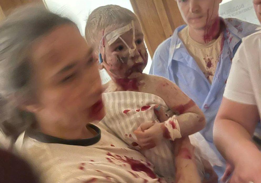 Ataque-a-hospital-pediatrico-en-Ucrania-3-992x694