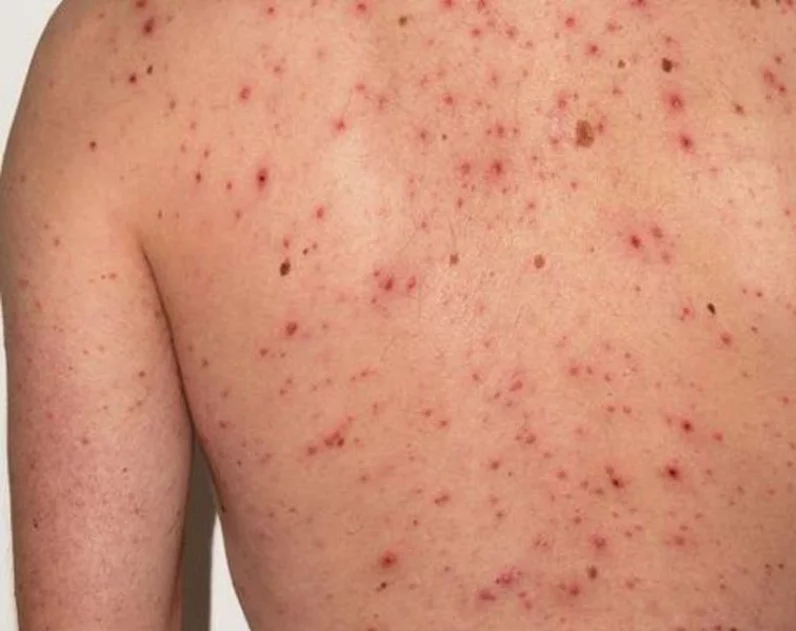 10_Nacionales_26_-3p01