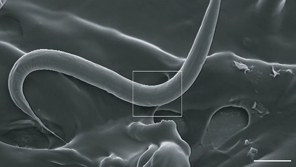 investigadores-barcelona-consiguen-ampliar-esperanza-vida-gusanos-elegans_97