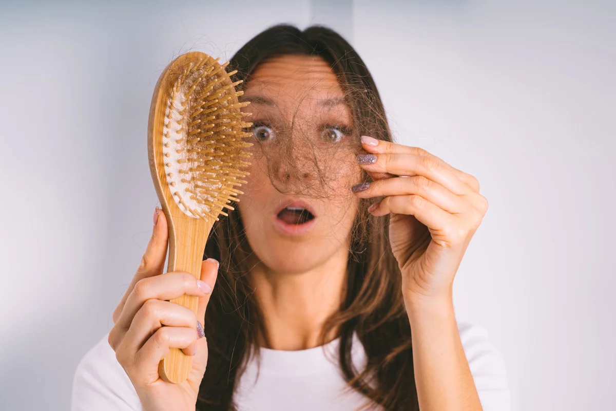 caida-cabello-alopecia