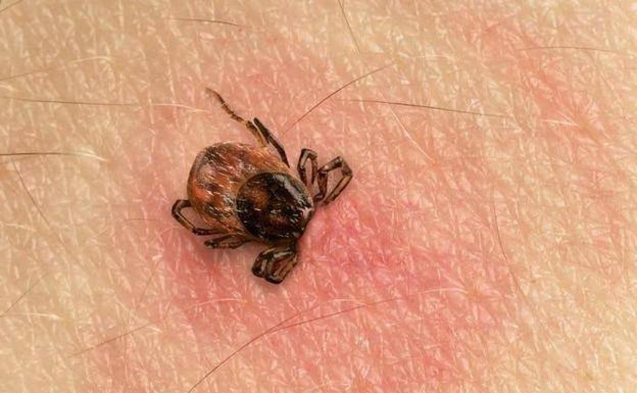 como-acabar-garrapatas-casa-kxuB-U170671881879irF-1248x770@La Verdad