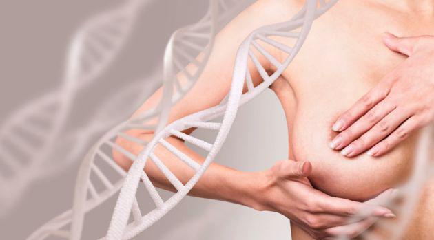 Sociedad-espanola-de-senologia-y-patologia-mamaria-cancer-de-mama-6