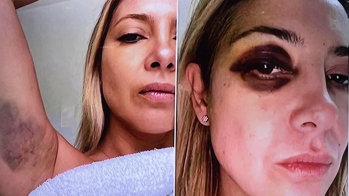 venis-golpeandome-hace-tres-dias-seguidos-se-filtraron-fotos-chats-denuncia-fabiola-yanez-alberto-fernandez-1046575-232320